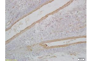 Formalin-fixed and paraffin embedded embryonic rhabdomyoma labeled with Anti-MyoD1/Myf3 Polyclonal Antibody, Unconjugated (ABIN740340) at 1:200 followed by conjugation to the secondary antibody (MYOD1 抗体  (AA 51-150))