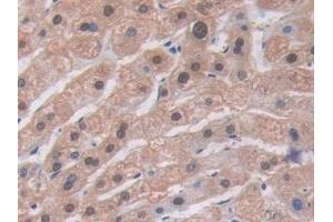 Detection of ALT in Human Liver Tissue using Polyclonal Antibody to Alanine Aminotransferase (ALT) (ALT 抗体  (AA 255-492))