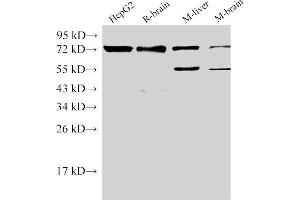 Western Blot analysis of 1)HepG2, 2)Rat brain, 3)Mouse liver, 4)Mouse brain using CD146 Ployclonal Antibody at dilution of 1:500. (MCAM 抗体)
