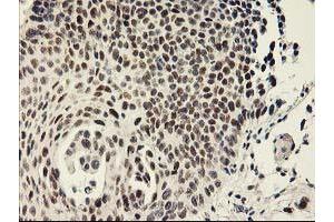 Image no. 2 for anti-General Transcription Factor IIF, Polypeptide 1, 74kDa (GTF2F1) antibody (ABIN1500597) (GTF2F1 抗体)