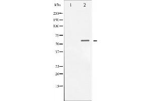 Western blot analysis of Chk1 phosphorylation expression in MCF7 whole cell lysates,The lane on the left is treated with the antigen-specific peptide. (CHEK1 抗体  (pSer317))