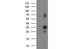 Western Blotting (WB) image for anti-Pleckstrin Homology Domain Containing Family A3 (PLEKHA3) antibody (ABIN1500273) (PLEKHA3 抗体)