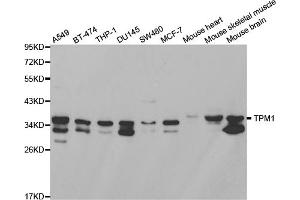 Western blot analysis of extracts of various cell lines, using TPM1 antibody (ABIN2989338) at 1/1000 dilution. (Tropomyosin 抗体)