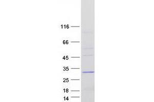 Validation with Western Blot