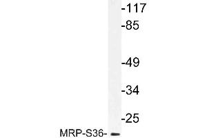 Western blot (WB) analysis of MRP-S36 antibody in extracts from HepG2 cells. (MRPS36 抗体)