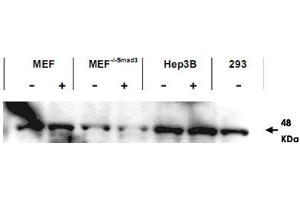 Western blot using SMAD3 polyclonal antibody  shows detection of endogenous SMAD3 in both unstimulated and stimulated cell lysates. (SMAD3 抗体  (AA 417-425))