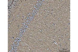 IHC analysis of EAAT1/SLC1A3 using anti-EAAT1/SLC1A3 antibody (ABIN7602879).