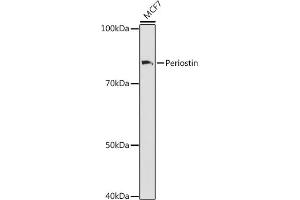 Western blot analysis of extracts of MCF7 cells, using Periostin antibody (ABIN7269226) at 1:1000 dilution. (Periostin 抗体)