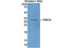 Western blot analysis of the recombinant protein. (CD25 抗体  (AA 22-243))
