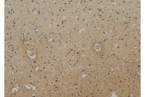 ABIN6257165 and ABIN6275114 at 1/100 staining Human brain tissue by IHC-P. (EPN3 抗体  (Internal Region))