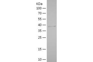 PLA2G12A Protein (AA 24-189) (His-IF2DI Tag)