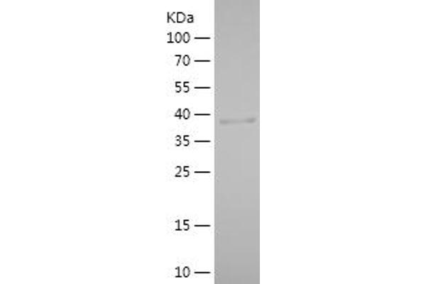 PLA2G12A Protein (AA 24-189) (His-IF2DI Tag)