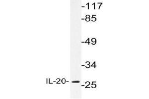 Western blot (WB) analysis of IL-20 antibody in extracts from A549 cells. (IL-20 抗体)