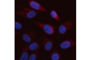 IF analysis of ARAF using anti-ARAF antibody (ABIN6719439).