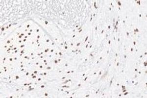 Immunohistochemistry (Paraffin-embedded Sections) (IHC (p)) image for anti-Ring Finger Protein 1 (RING1) antibody (ABIN7075467)