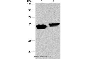 Western blot analysis of Raji and Hela cell, using AVEN Polyclonal Antibody at dilution of 1:200 (AVEN 抗体)