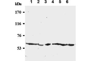 Western Blotting (WB) image for anti-Cell Division Cycle 25 Homolog C (S. Pombe) (CDC25C) antibody (ABIN487484) (CDC25C 抗体)