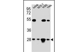 TF Antibody (C-term) (ABIN654229 and ABIN2844063) western blot analysis in Hela,Jurkat,K562,MCF-7 cell line lysates (35 μg/lane). (TFAM 抗体  (C-Term))