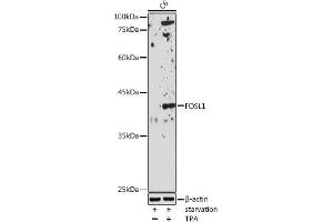 Western blot analysis of extracts of C6 cells, using FOSL1 antibody (ABIN6131653, ABIN6140738, ABIN6140739 and ABIN6221016) at 1:1000 dilution. (FOSL1 抗体  (AA 1-100))