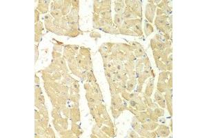 Immunohistochemistry (Paraffin-embedded Sections) (IHC (p)) image for anti-Proteasome (Prosome, Macropain) 26S Subunit, ATPase, 2 (PSMC2) (AA 1-160) antibody (ABIN3015801)