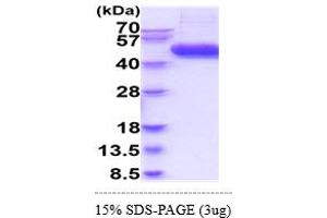 SDS-PAGE (SDS) image for Interleukin 1 Receptor, Type II (IL1R2) (AA 14-343) (Active) protein (His tag) (ABIN5777947)