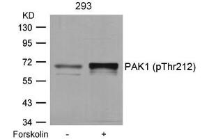 Western blot analysis of extracts from 293 cells untreated or treated with forskolin using PAK1(Phospho-Thr212) Antibody. (PAK1 抗体  (pThr212))