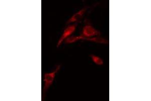 ABIN6274272 staining COLO205 cells by IF/ICC. (FXR2 抗体  (C-Term))