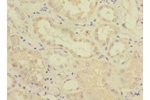 Immunohistochemistry of paraffin-embedded human kidney tissue using ABIN7153109 at dilution of 1:100 (FTCD 抗体  (AA 412-541))
