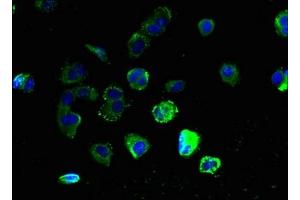 Immunofluorescent analysis of MCF-7 cells using ABIN7153339 at dilution of 1:100 and Alexa Fluor 488-congugated AffiniPure Goat Anti-Rabbit IgG(H+L) (GPR3 抗体  (AA 300-330))