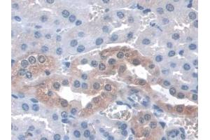 Detection of ITGa3 in Mouse Kidney Tissue using Polyclonal Antibody to Integrin Alpha 3 (ITGa3) (ITGA3 抗体  (AA 33-236))