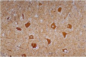 Immunohistochemistry staining of human cerebellum (paraffin-embedded sections) with anti-neurofilament heavy protein (NF-01). (NEFH 抗体)