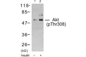 Western blot analysis using Akt (phospho-Thr308) antibody (E011055): Lane1: The extract from 293 cells untreated, Lane 2: The extract from 293 cells treated with insulin. (AKT1 抗体  (pThr308))