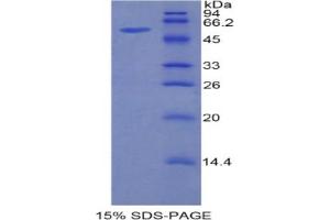 SDS-PAGE analysis of Mouse HGFAC Protein. (HGFA 蛋白)