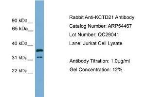 WB Suggested Anti-KCTD21  Antibody Titration: 0. (KCTD21 抗体  (Middle Region))