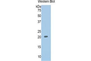 WB of Protein Standard: different control antibodies against Highly purified E. (SERPINA6 ELISA 试剂盒)
