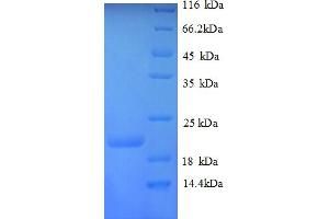 SDS-PAGE (SDS) image for Plexin A1 (PLXNA1) (AA 986-1152), (partial) protein (His tag) (ABIN5712904)