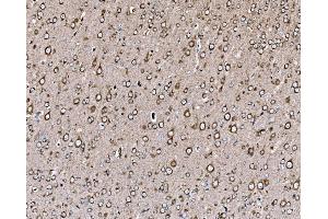 IHC analysis of PI 3 Kinase p85 alpha/PIK3R1 using anti-PI 3 Kinase p85 alpha/PIK3R1 antibody (ABIN7599781).