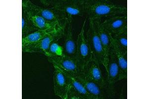 IF analysis of SUCLG2 using anti-SUCLG2 antibody (ABIN7601694).