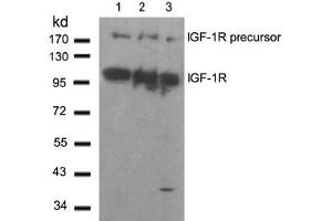 Image no. 2 for anti-Insulin-Like Growth Factor 1 Receptor (IGF1R) (Tyr1280) antibody (ABIN197576) (IGF1R 抗体  (Tyr1280))