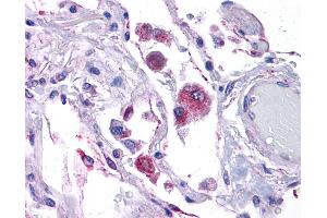 Immunohistochemistry (IHC) image for anti-KIT Ligand (KITLG) (Middle Region) antibody (ABIN2781827) (KIT Ligand 抗体  (Middle Region))