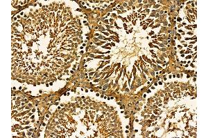ABIN7095660 and ABIN7099722 at 1/100 staining rat testis tissue by IHC-P. (Ethanolamine Kinase 1 抗体)