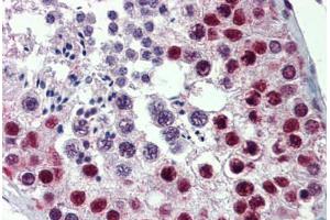 Human Testis: Formalin-Fixed, Paraffin-Embedded (FFPE) (HDAC1 抗体  (AA 271-477))
