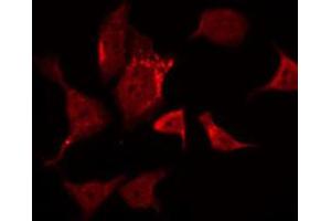 anti-FER Tyrosine Kinase (FER) (pTyr402) antibody