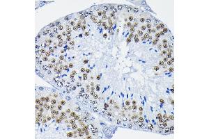 Immunohistochemistry (IHC) image for anti-Polypyrimidine Tract Binding Protein 2 (PTBP2) (AA 1-280) antibody (ABIN6146373)