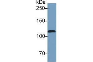 Detection of NOS2 in Human Serum using Monoclonal Antibody to Nitric Oxide Synthase 2, Inducible (NOS2) (NOS2 抗体  (AA 734-966))