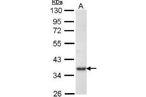 WB Image Sample (30 ug of whole cell lysate) A: Molt-4 , 10% SDS PAGE antibody diluted at 1:1000 (PRPS1 抗体)