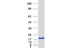 Western Blotting (WB) image for PDZ Domain Containing 11 (PDZD11) protein (Myc-DYKDDDDK Tag) (ABIN2728619)