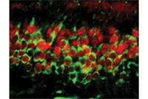 Dnmt3a Immunofluorescence. (DNMT3A 抗体  (C-Term))