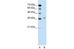 WB Suggested Anti-ALAD  Antibody Titration: 0. (ALAD 抗体  (N-Term))
