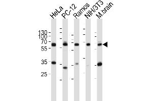 Western blot analysis of lysates from HeLa, rat PC-12, Ramos, mouse NIH/3T3 cell line, mouse brain tissue lysate(from left to right), using PKM2-N491 at 1:1000 at each lane. (Pyruvate Kinase 抗体  (C-Term))
